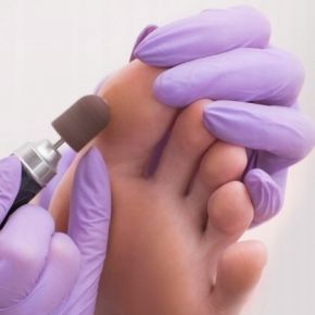 AllMed kapturek ścierny 10mm gradacja 150 do pedicure brązowy 10 sztuk