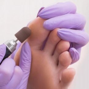 AllMed kapturek ścierny 13mm gradacja 180 do pedicure różowy 10 sztuk