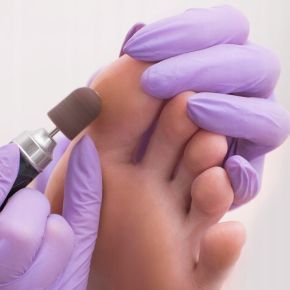 Kapturek ścierny korund do pedicure biały 10 sztuk 10mm gradacja 220