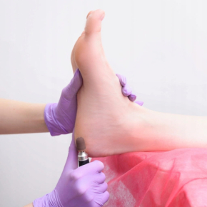 MaluLac kapturki do pedicure 10mm gradacja 100 - 10 sztuk fioletowe