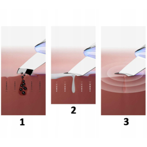 Bezprzewodowy peeling kawitacyjny 5w1 do liftingu, nawilżania i oczyszczania twarzy + 2 nakładki gratis
